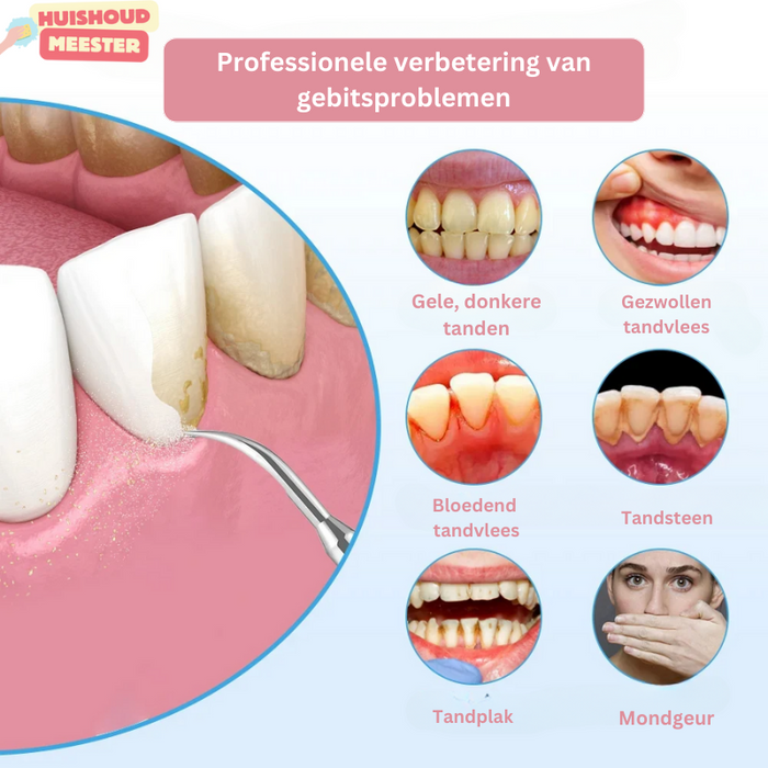 Dentalpro | Effectief verwijderen van tandsteen en tandplak