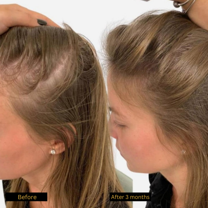 Geavanceerde Haarherstelolie - holistische, alles-in-één aanpak voor haargezondheid - merkbare groei na 4 weken - 35ml - huishoudmeester